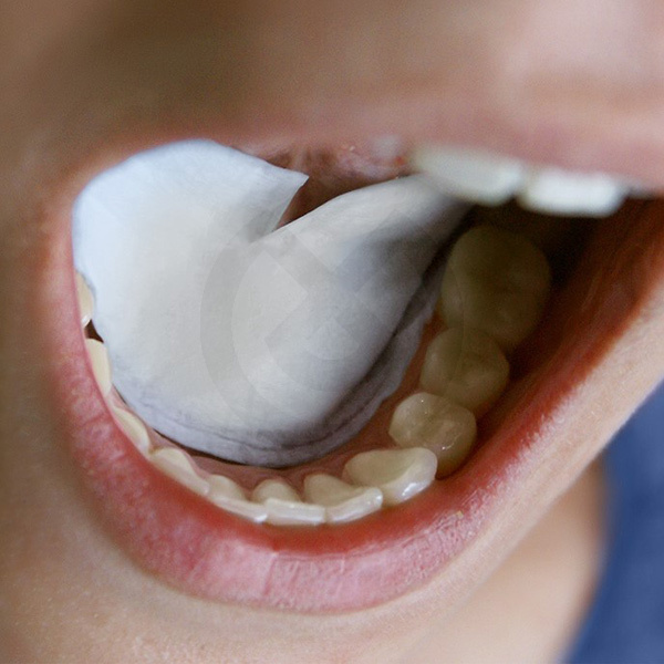 Drydent Sublingual salivabsorberare Drydent Sublingual salivabsorberare