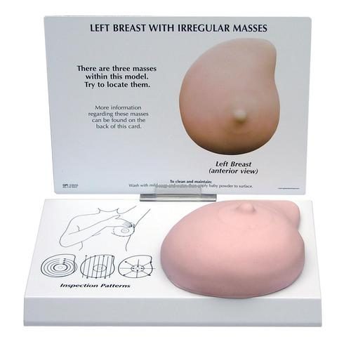 Vänster bröstmodell med oregelbundna massor
