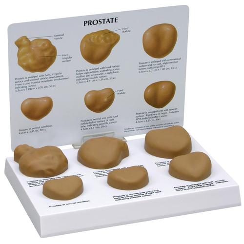 Prostatamodell