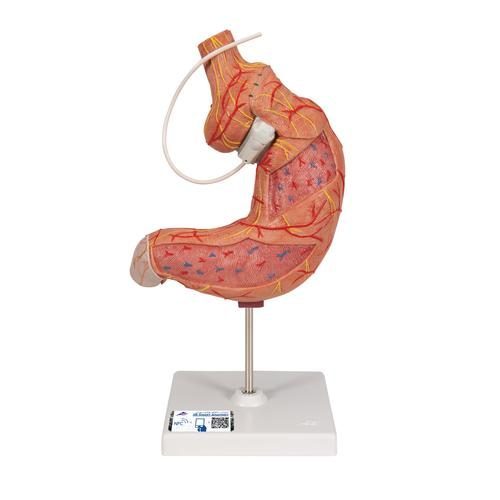 Mänsklig Magmodell med Gastriskt Band, 2 delar