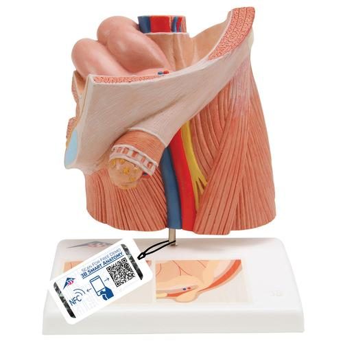 Ljumskbråck urologimodell
