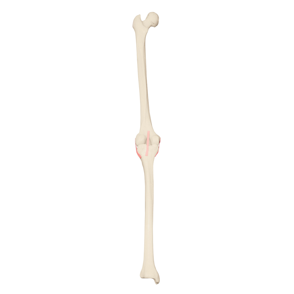 ORTHObones Premium Vänster Knä