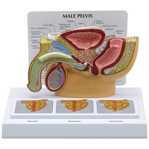 Manligt bäcken med 3D-prostataram