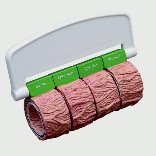 Artärsnitt (4) (stor) – med handtag