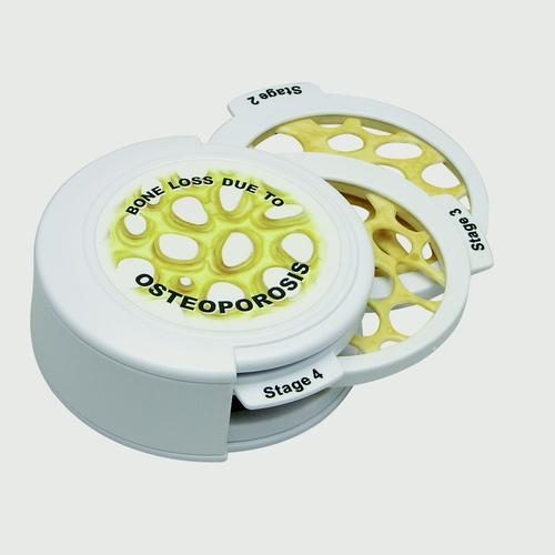 Gängat diskset – 4 st Osteoporos