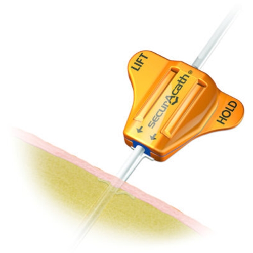 Fixering CVK SecurAcath – 4F – 10 st