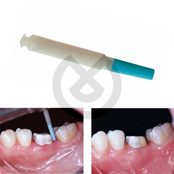 Opticlean 12 st (950) Kerr – KERR