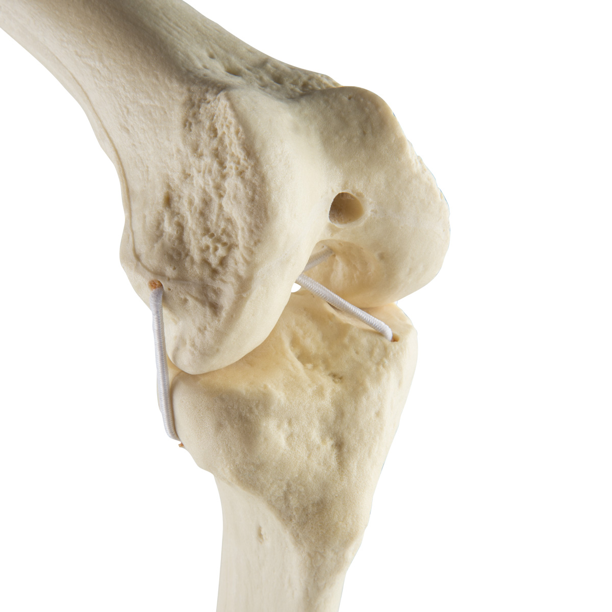 ORTHObones Standard Knä Höger