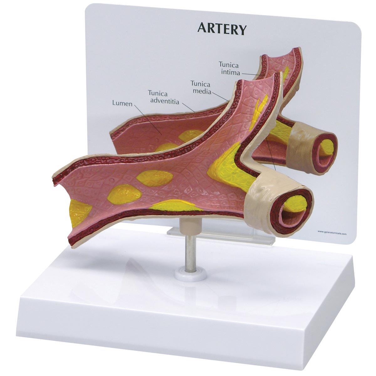 Arteriemodell