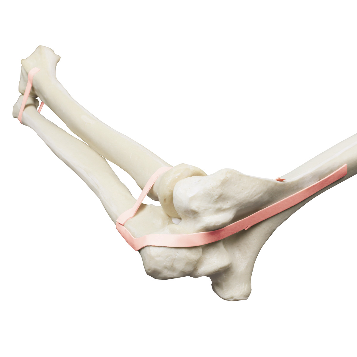Armbåge, Ulna, Radius – ORTHObones Premium