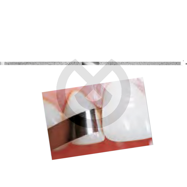Polerstrips med diamantkorn DS25 Polerstrips med diamantkorn DS25