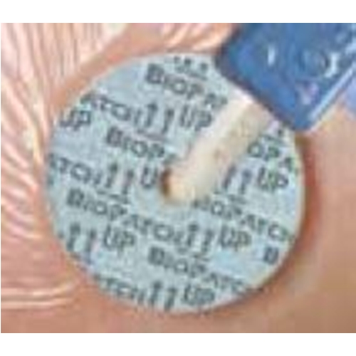 Kompress klorhexidin Biopatch disk – Ø1,9cm hål 1,5mm < 6Fr - 40 st