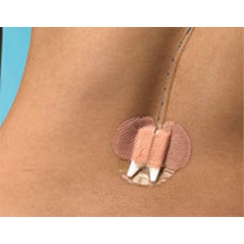 Fixeringsförband Epi-Guard – för epiduralkateter – 25 st