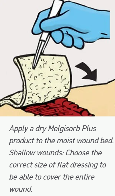 Melgisorb Plus Alginate Dressing