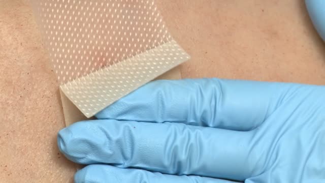 Mepiform Scar Treatment Dressing
