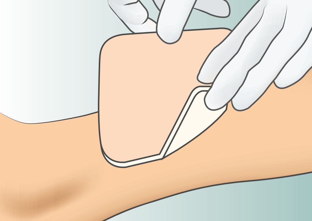 Lyofoam Max Foam Dressing