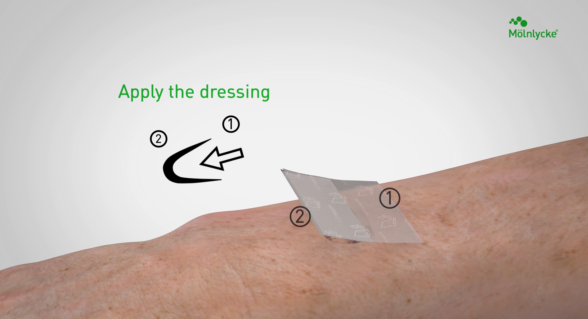 Mepitel One Silicone Wound Contact Layer
