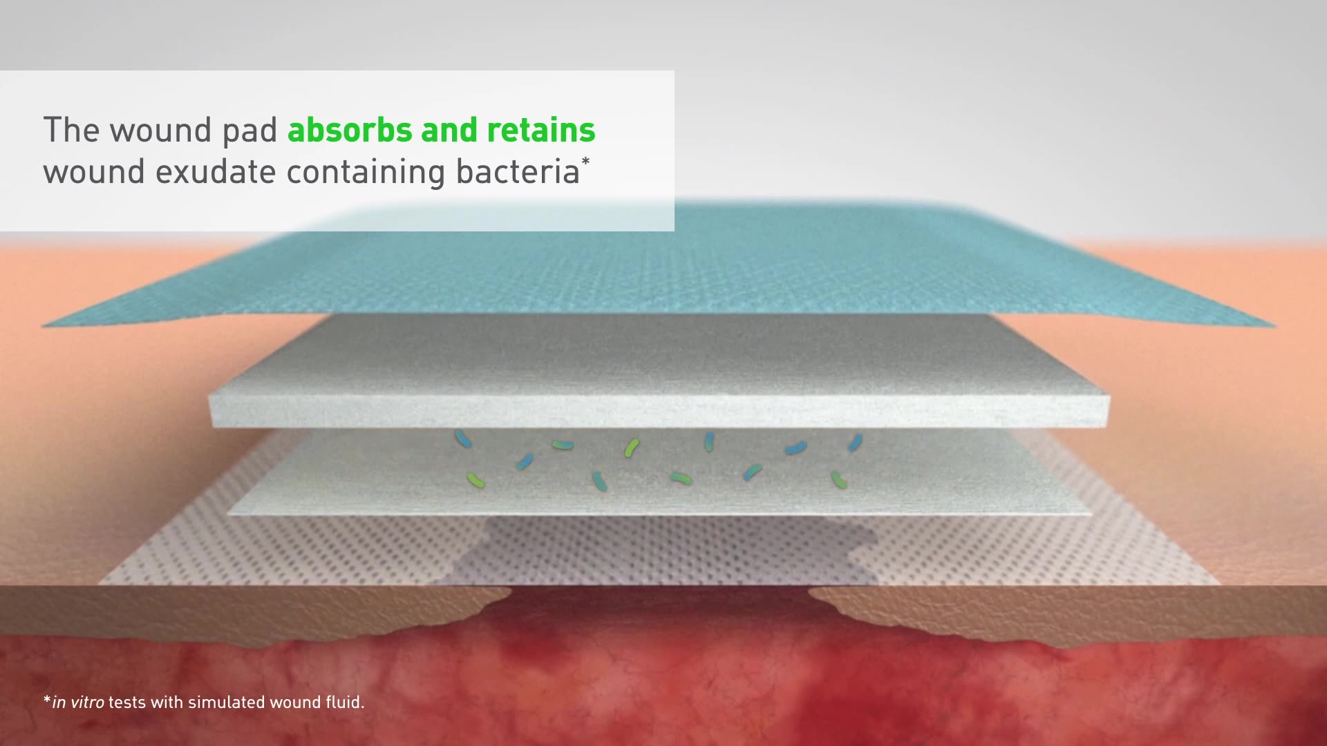 Mextra Superabsorbent Superabsorbent Dressing