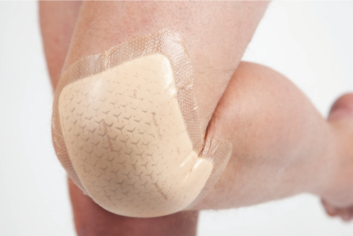 Mepilex Border Comfort Foam Dressing