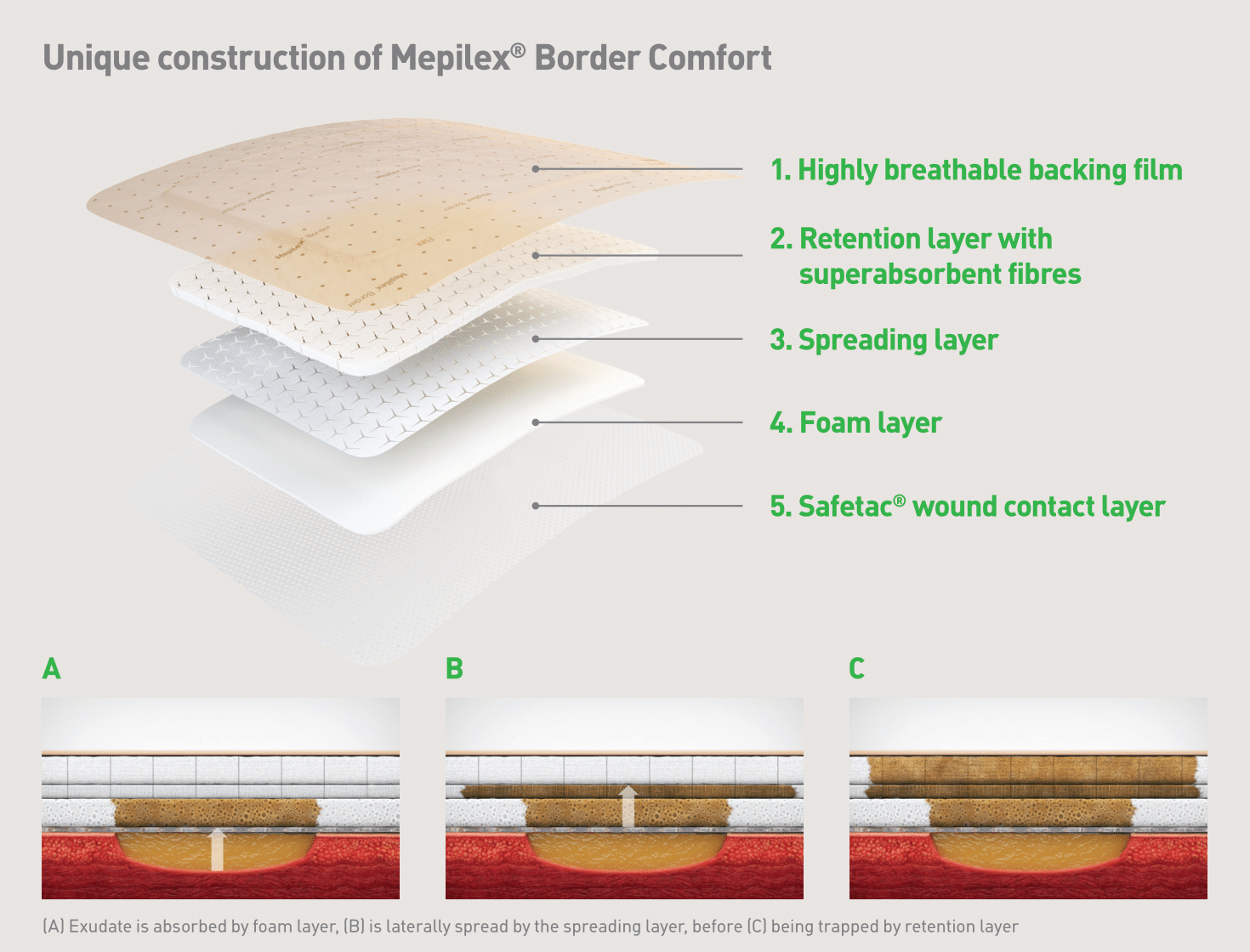 Mepilex Border Comfort Foam Dressing